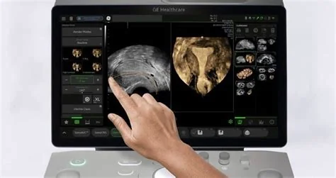 GE HealthCare Announces $35M BARDA Boost for AI Ultrasound